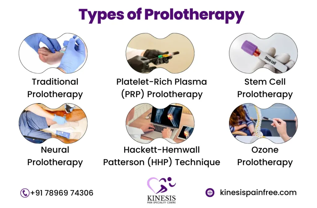Prolotherapy Treatment in Chennai | Kinesis Painfree